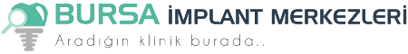 Bursa İmplant Merkezleri